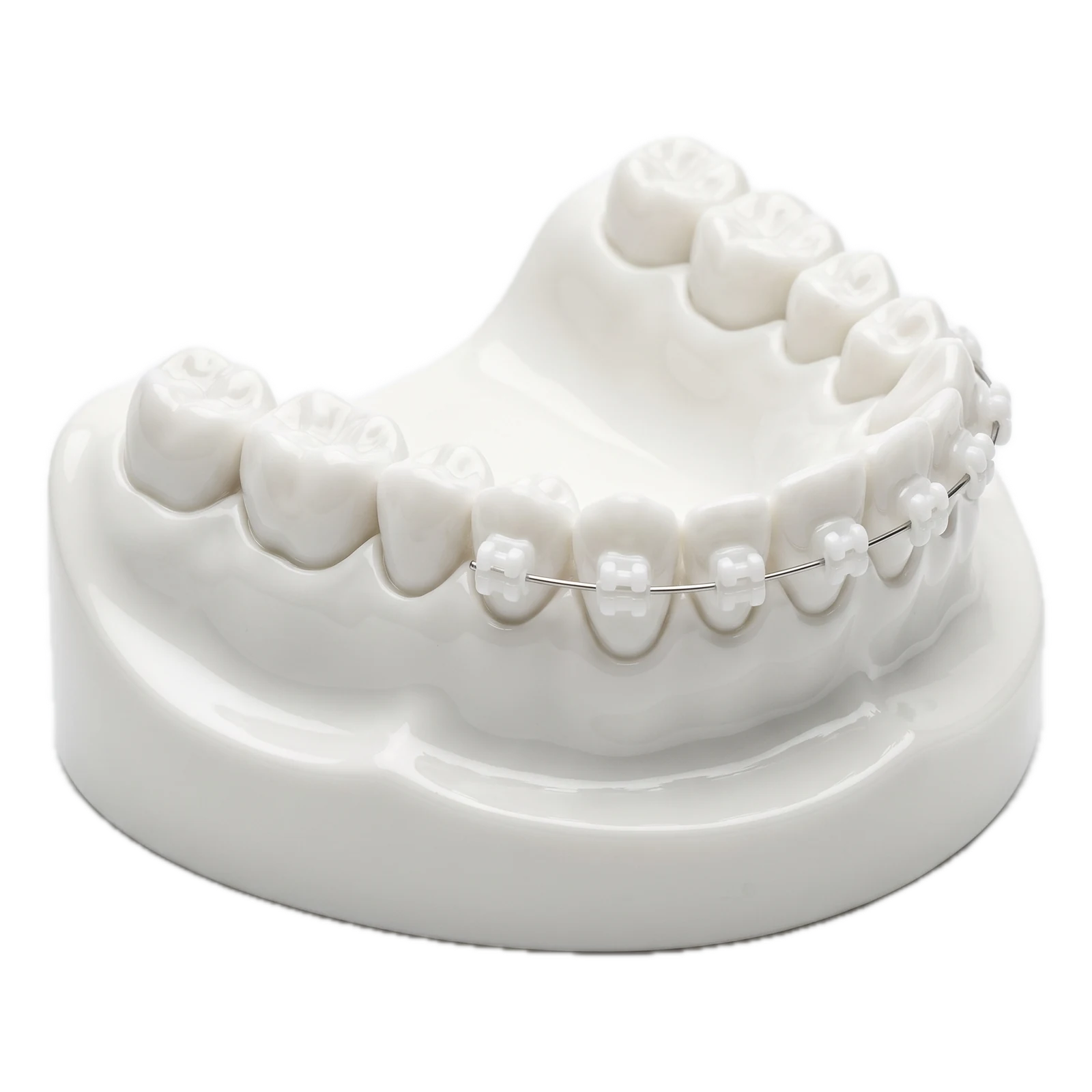 Zahnbogen aus Porzellan mit feinen Brackets, illustratives 3D-Modell